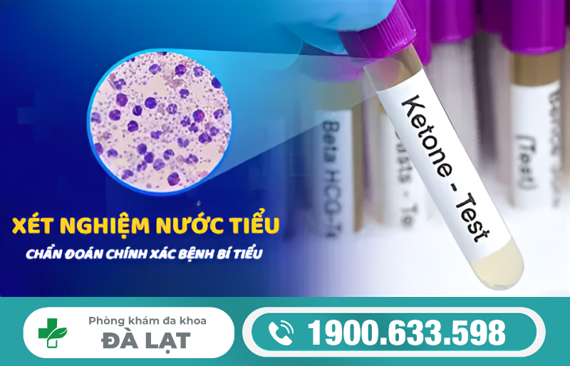 Hình ảnh minh họa